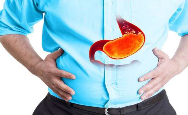 Acidity Karan Lakshan Upchar Upay