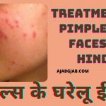 Treatment Of Pimples on Faces In Hindi