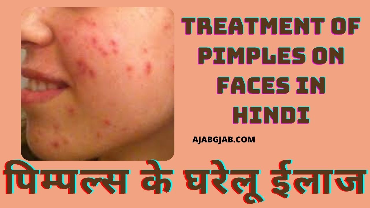 Treatment Of Pimples on Faces In Hindi